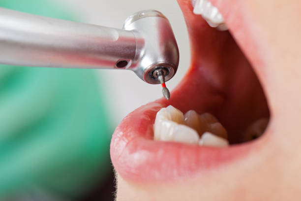 Best Weekend Emergency Dentist in Fort Valley, GA